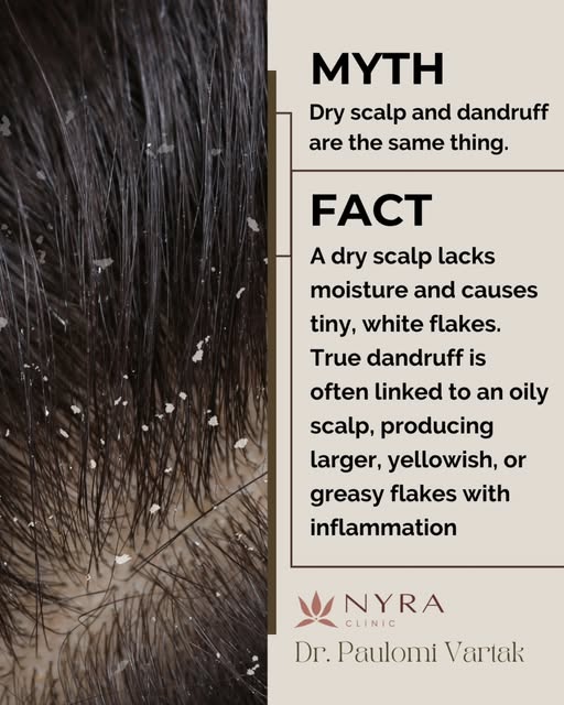 Dry Scalp ≠ Dandruff! 

They may look similar, but the cause and treatment can be very different.

 
