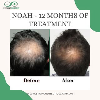 Noah is a 31 year old male who has been on the program for 12 months.  Everyone's progress is differ