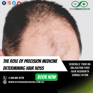 The Role of Precision Medicine in Determining Hair Hoss. Schedule Your No-Obligation Free Hair Regro