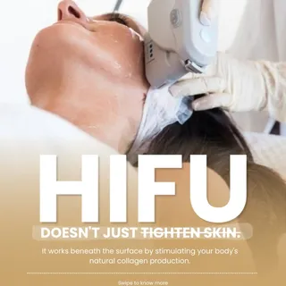 Think HIFU is simply a skin-tightening treatment? There's more to understand. ✨

HIFU uses focused u