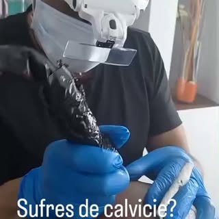 La mejor inversión es invertir en ti!. En tu autoestima y seguridad.  Micropigmentación Capilar.#alo