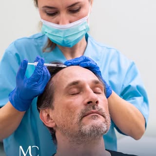 Die Haartransplantation ist ein Verfahren, bei dem gesunde Haarfollikel aus dem Spenderbereich entno