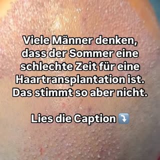 Entscheidend ist nicht die Jahreszeit, sondern wie man sich in den ersten Tagen nach der Behandlung 