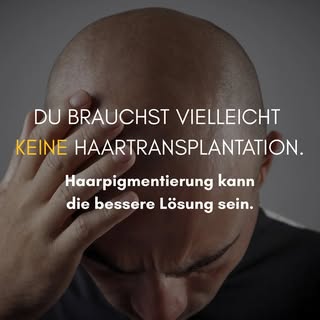 Micro Haarpigmentierung oder Haartransplantation? Das klären wir in einem kostenlosen Beratungsgespr