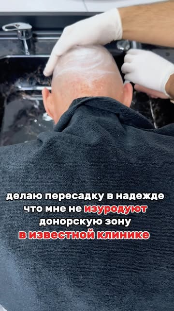 Если ваш донорский запас настолько мал и не позволяет получить успешный эстетический результат, то п
