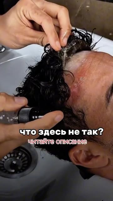 СИСТЕМА ВОЛОС НИКОГДА НЕ БУДЕТ ПОЛНОЦЕННОЙ ЗАМЕНОЙ ПЕРЕСАДКЕ ВОЛОС! 

Все, что вам нужно знать и при