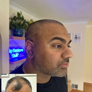 Restyle from Scalp Restore by Martin