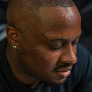 A subtle change. A lasting impact.

Scalp Micropigmentation creates the appearance of a fuller, shar