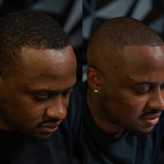 Small Change. Big Impact.

Every treatment is customized to match your natural hairline, skin tone, 