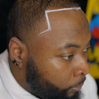 Client’s Back in control ✍🏽

Scalp Micropigmentation isn’t about changing who you are, it’s about h