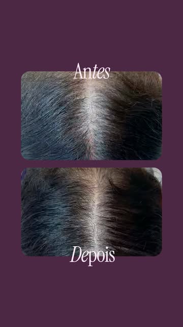 Cada antes e depois conta uma história. Neste caso, o cabelo também acompanhou uma grande transforma