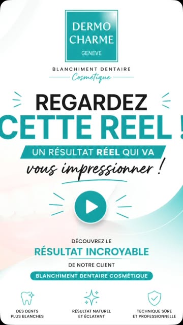 Découvrez le résultat réel de notre blanchiment dentaire cosmétique.

Un sourire plus lumineux, avec