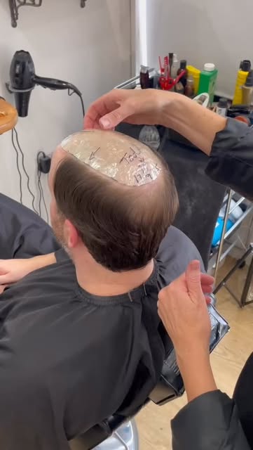 Let’s clear this up 👉 A men’s hair system isn’t a wig. 🙅‍♂️

It’s a customised, non-surgical solut