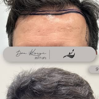 ✨ Si algo tenemos en común mis pacientes y yo, es que buscamos resultados 100% naturales, con expect