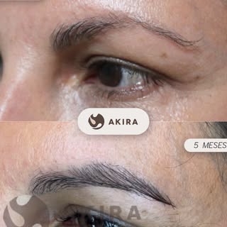 ✨ Transformación real, resultados naturales ✨

¿Te imaginas recuperar la forma y densidad de tus cej