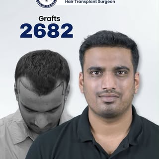 2682 Grafts. One Powerful Transformation. 💙
Real results. Real transformation. Real confidence. ✨
T