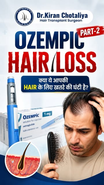 🚨 Ozempic & Hair Loss: Is There a Connection?

Ozempic is widely discussed for weight management, b