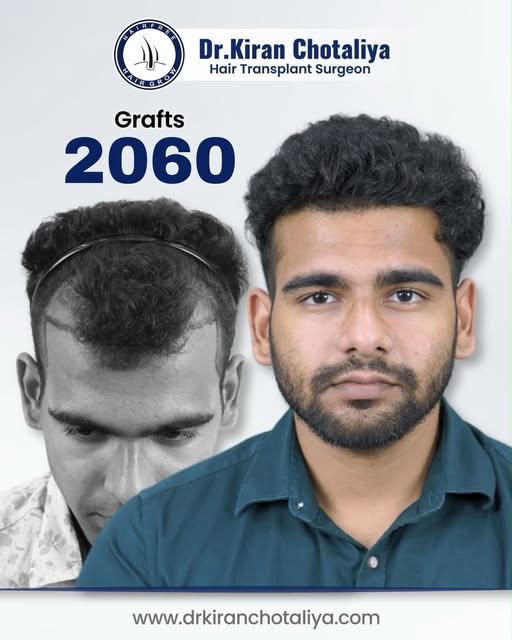 ✨ Real Results. Real Transformation. ✨
From hair loss concerns to a confident new look—your transfor