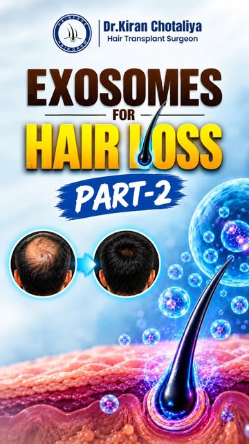 🧬 Exosomes for Hair Loss — Part 2! 💇‍♂️✨

Hair loss isn’t always just about genetics. Understandin