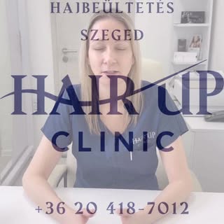 Hajbeültetés - Szeged - Hair Up Clinic