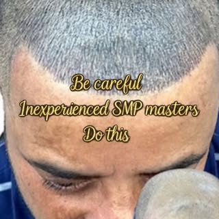 Be Careful Who You Trust With Your SMP

Scalp Micropigmentation (SMP) can be life-changing…
But in t