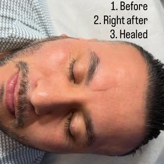 #Men #eyebrows #microblading