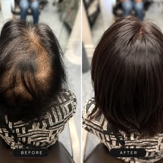 Hair is more than just hair. It’s confidence, self-expression, and feeling like yourself again. 🤍

