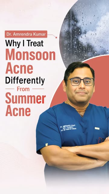 Dr. Amrendra Kumar explains: 👨‍⚕️

🌧️ Monsoon acne is not the same as summer acne — and your skinc