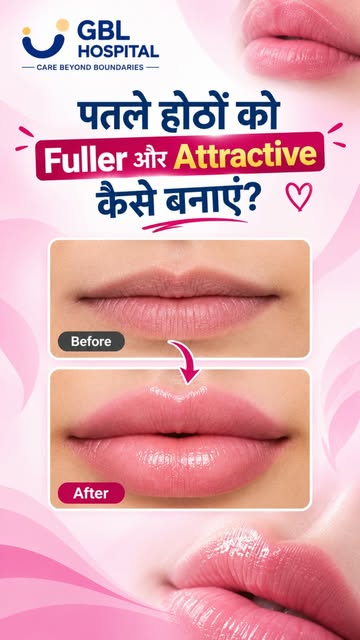🛑 पतले होठों को Fuller और Attractive कैसे बनाएं? 💋

अगर आप thin lips को enhance करना चाहती हैं, तो