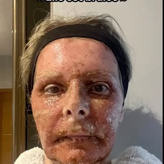 Tout d’abord un IMMENSE ET SINCÈRE merci à notre magnifique, charmante et adorable patiente qui nous