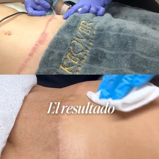 Así trabajamos en MakeOver.
Así quedan nuestras pacientes.

No hay secreto detrás de esto.
Hay diagn