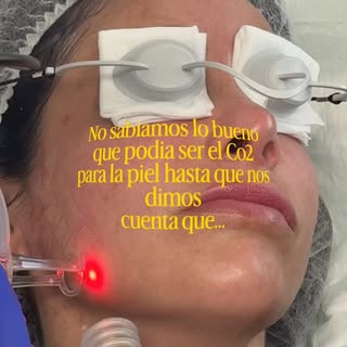 ✨ ¿Por qué el CO₂ Laser es uno de los tratamientos más efectivos para rejuvenecer la piel?

Con el p