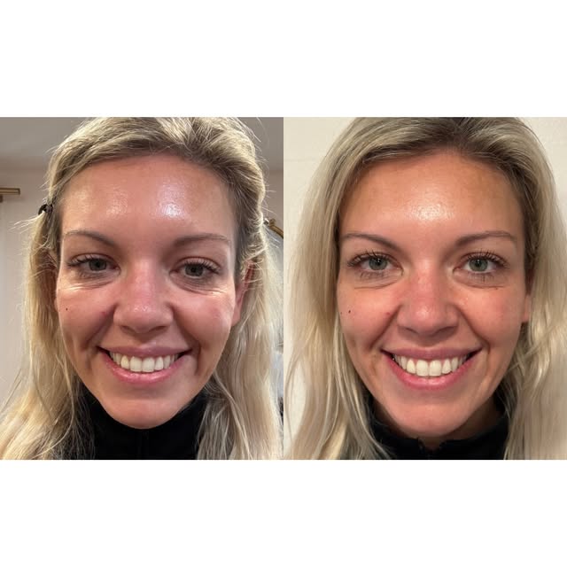 Ever feel like your face looks more tired than you actually feel?
Sometimes, it’s not about adding v
