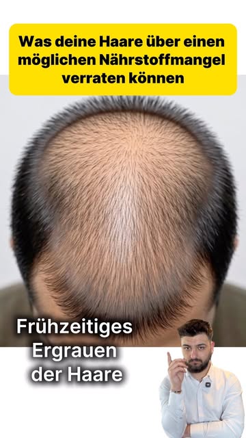 Haare verändern sich aus vielen Gründen – und nicht jede Veränderung bedeutet automatisch einen Nähr