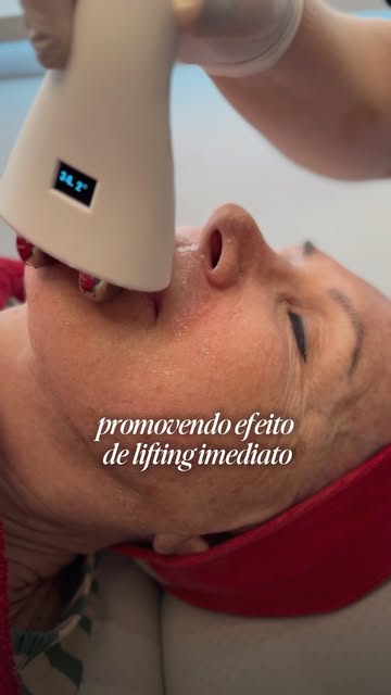 O Sectum utiliza radiofrequência para estimular a produção de colágeno, melhorar a firmeza e suaviza