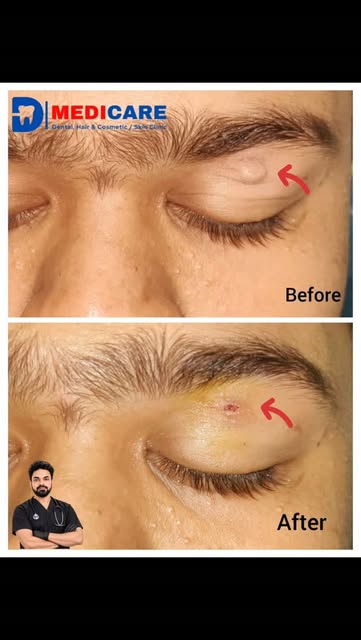 #muzaffarpur #cosmetictreatment #cosmetology