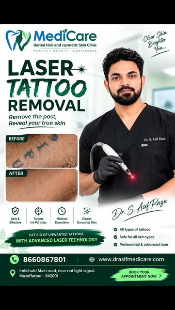 #muzaffarpur #tattooremoval #juranchapra #tattoo #bihar