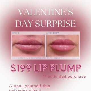 SURPRISE!! 

LIPS - Plump lips and correct smile lines.

Needle Free - Natural- Treatment time is ab