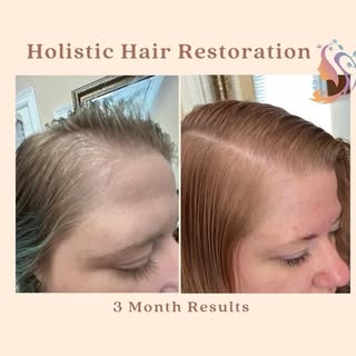 Check out these amazing results from just 3 months of treatment! 

Lets get you booked to start your