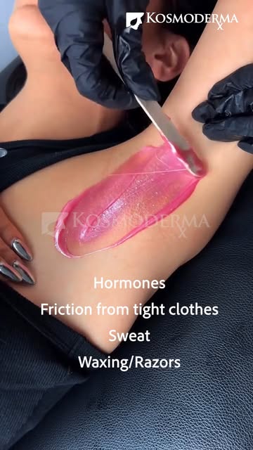 Noticing darkening in your intimate areas? You’re not alone.

Hormones, friction, sweat, shaving, an
