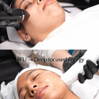 Loose skin, visible pores, and less definition? Your skin may need more than surface-level care.

RF
