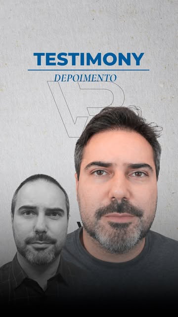 O depoimento do Osvanio toca num ponto importante: a queda de cabelo não acontece apenas no couro ca
