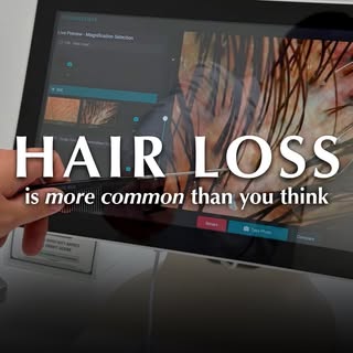 Hair Loss Awareness Month is a good reminder that hair loss rarely has just one story.

Genetics, ho