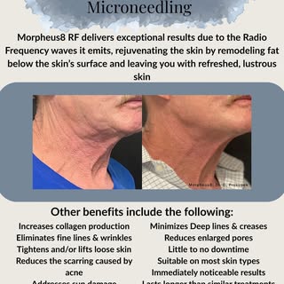 Ready for smoother, tighter, more radiant skin? ✨

Morpheus8 RF is an advanced skin rejuvenation tre