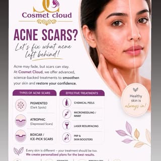 Acne scars ,not a problem any More!!
@Cosmet Cloud.