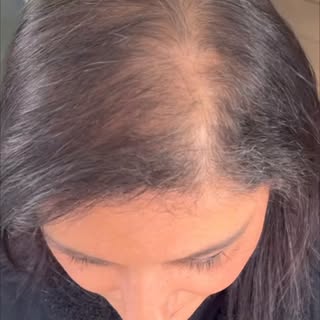 #haarpigmentierung #haarpigmentierungaachen #beautytech #neuesich #smp #fragenundantworten 

4 Sessi