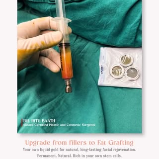Why replace what your body already has?

When it comes to facial rejuvenation, Fat Grafting offers a