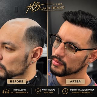 I am a CERTIFIED hair loss specialist, who specializes in nonsurgical hair loss solutions!
Ready for