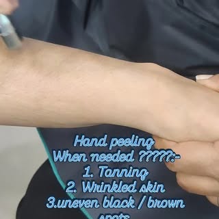 Do u have tanned hands ??
Get the best treatment AHM clinic..
Book your appointment now :- 70486-612