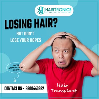 Hair Transplant: A permanent solution for a lifetime of confidence! 

Hair Transplant: A permanent s